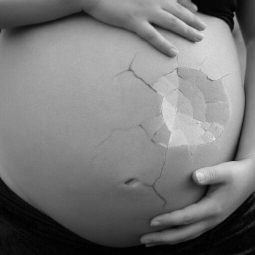 The Emotional Impact of Multiple Miscarriages: Finding Hope and Healing The Emotional Impact of Multiple Miscarriages: Finding Hope and Healing